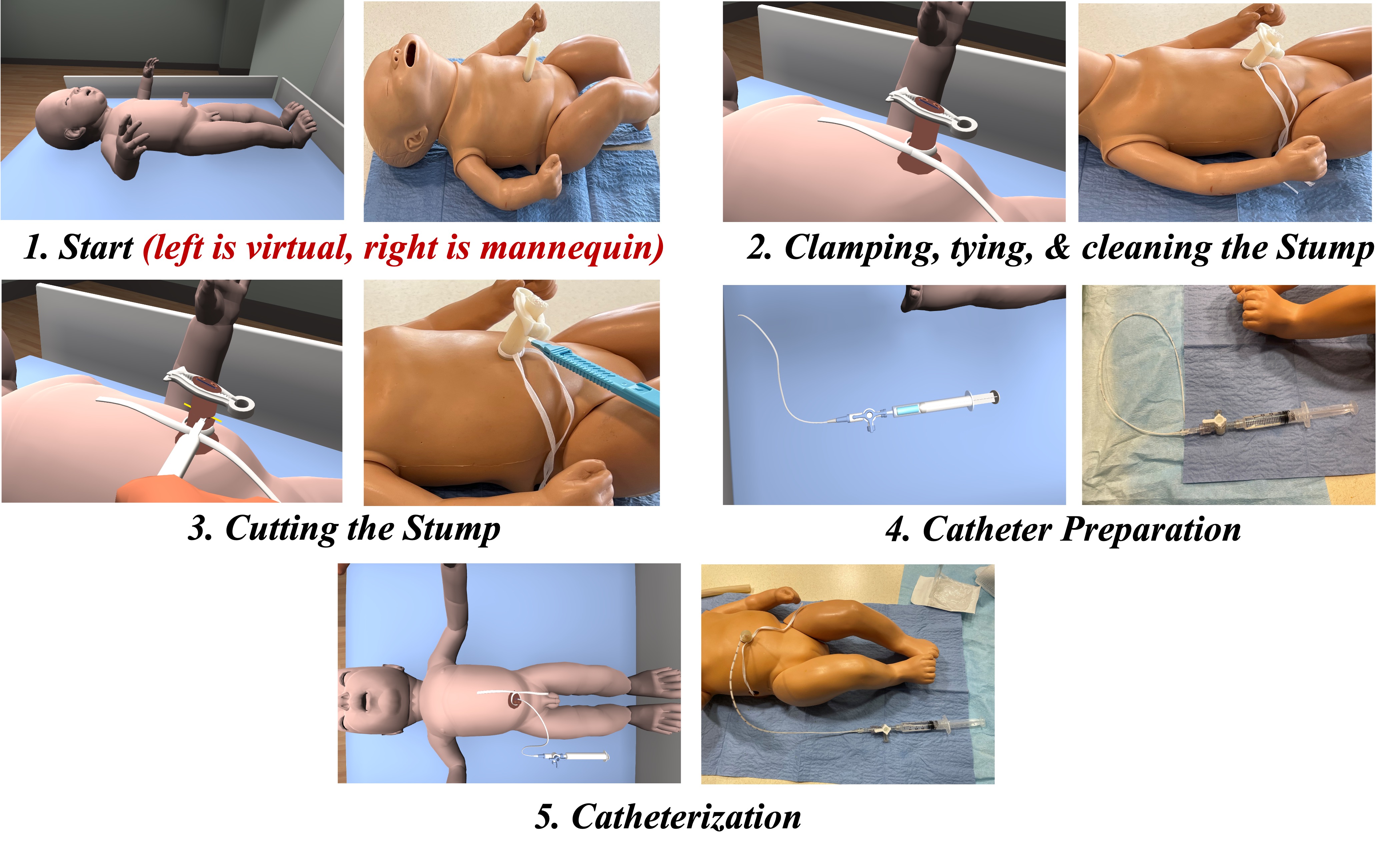 Development and usability of a virtual reality umbilical venous catheter placement simulator